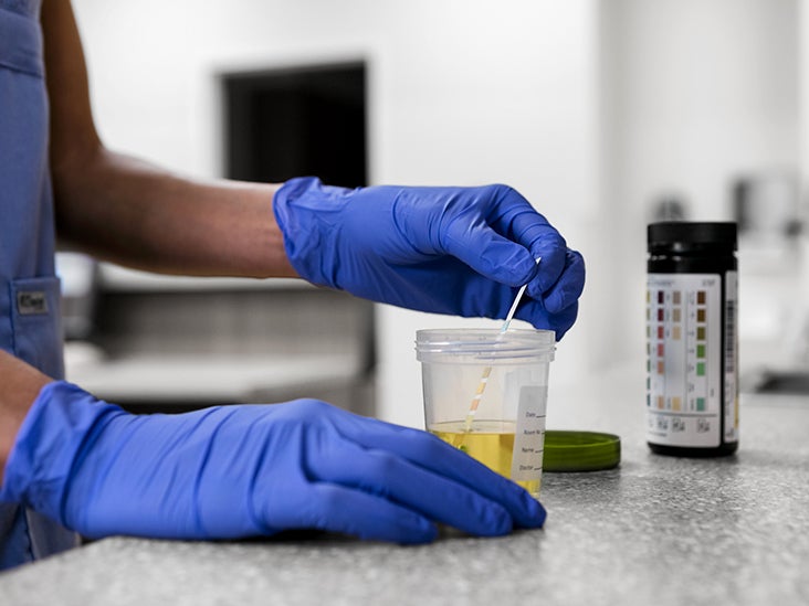 Urine drug tests: Uses, procedure, detection times, and results