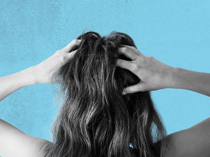 Itchy scalp and hair loss: Link, causes, and treatment