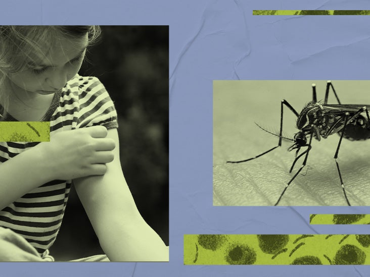 Terungkap! 4 Faktor Risiko yang Menjadikan Anda Rentan Terkena Virus Dengue