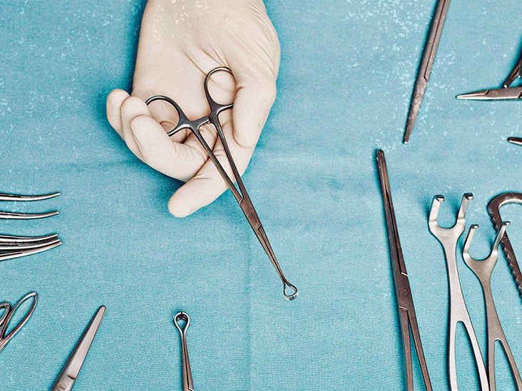 Trigger finger surgery Recovery time and outlook