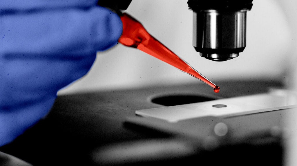 Leukemia: Causes, treatment, and early signs
