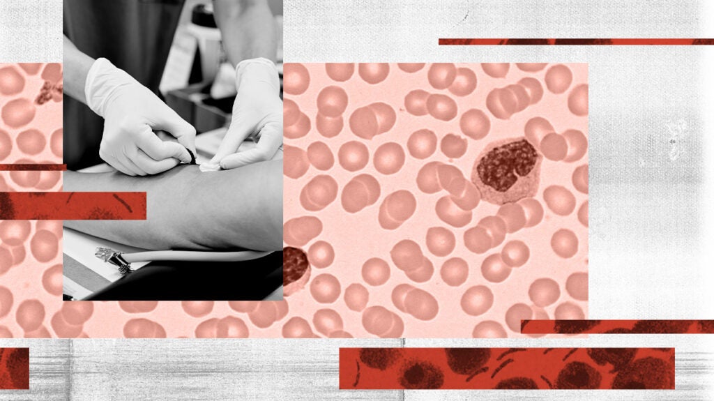 What causes a low platelet count (Thrombocytopenia)?