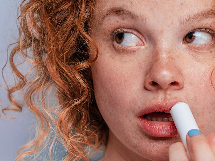 Eczema On The Lips: Types, Symptoms, Triggers, And Treatment