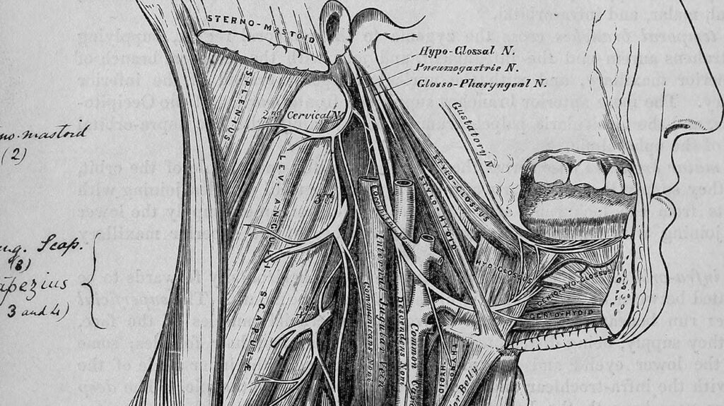 Sleep apnea implants: How they work, surgery, and risks