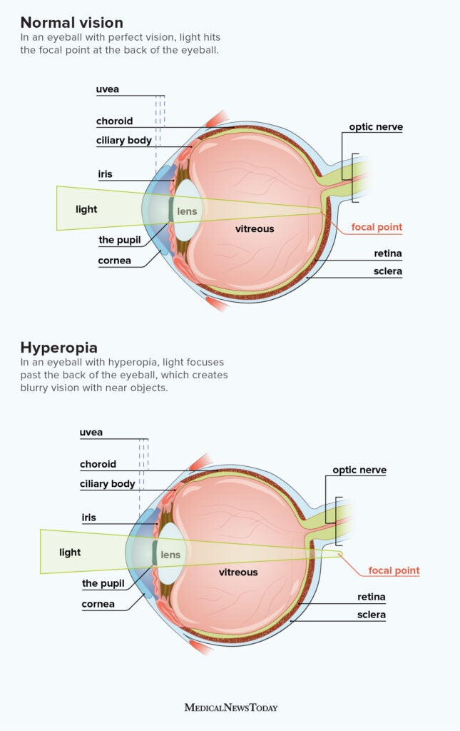 Eyesight and Eye Health