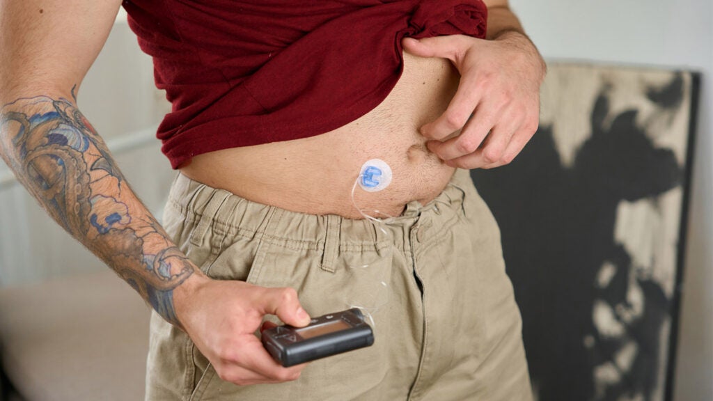 Diabetic-level glucose spikes seen in healthy people