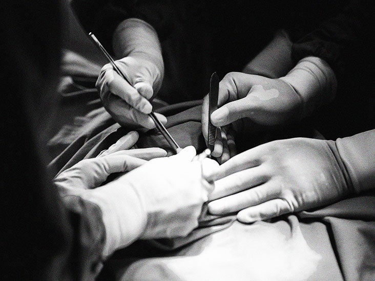 How much does a liver biopsy cost?