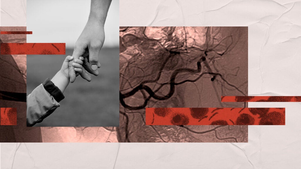 Mixed hyperlipidemia Causes, risk factors, treatment, and more