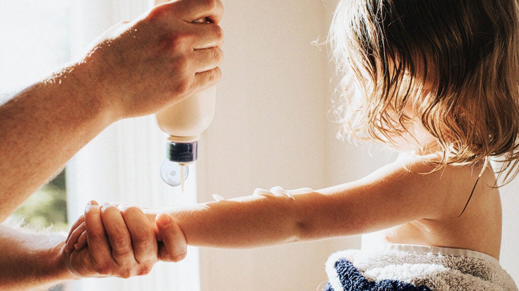 Treating eczema in kids Which moisturiser is best?
