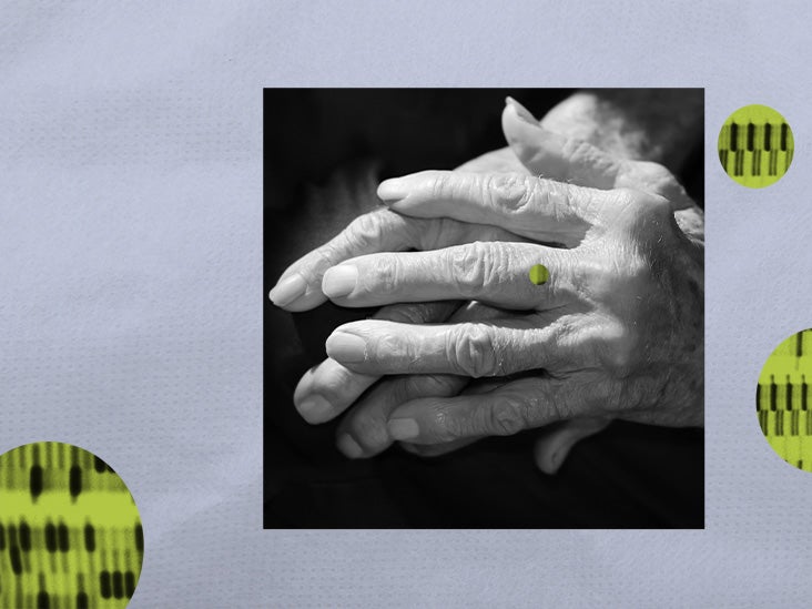 Is psoriatic arthritis Markers, tests, and more