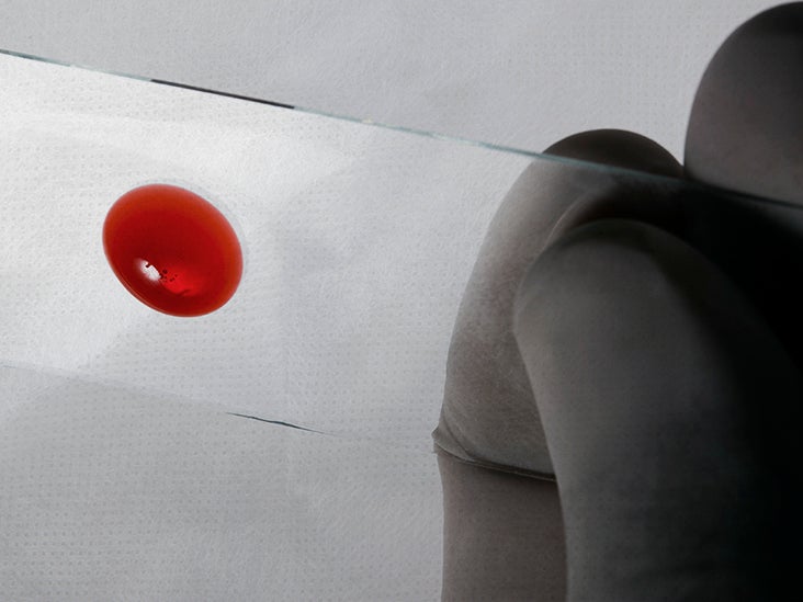 Shock liver Symptoms, treatment, and outlook