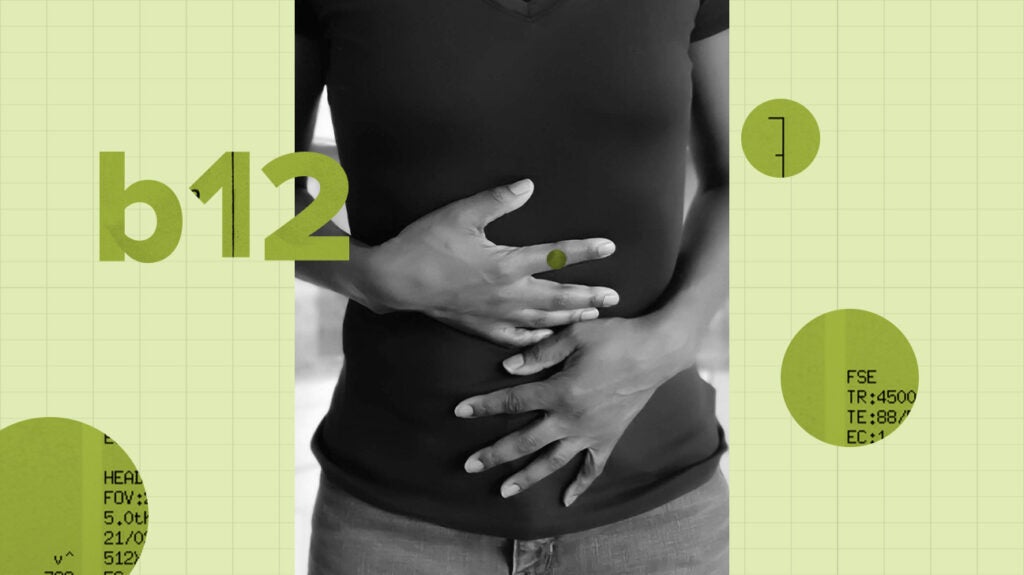 Vitamin B12 and ulcerative colitis Links and more