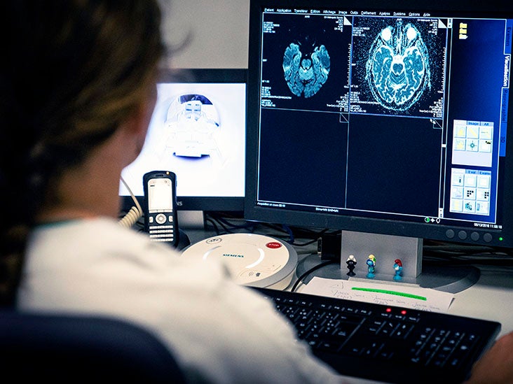 stroke_patients_GettyImages1219033434_Th