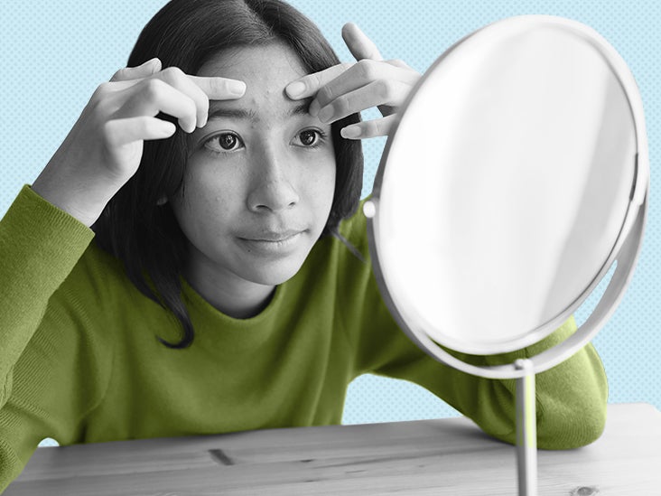 Whiteheads Home remedies and other selfcare tips