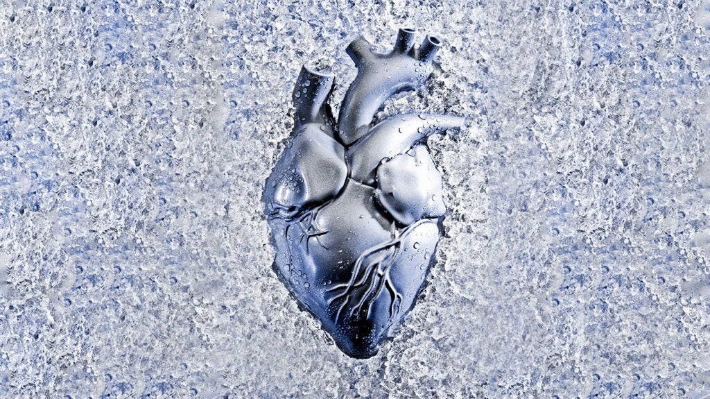 Heart with opposing rotation at apex (counter-clockwise) and base