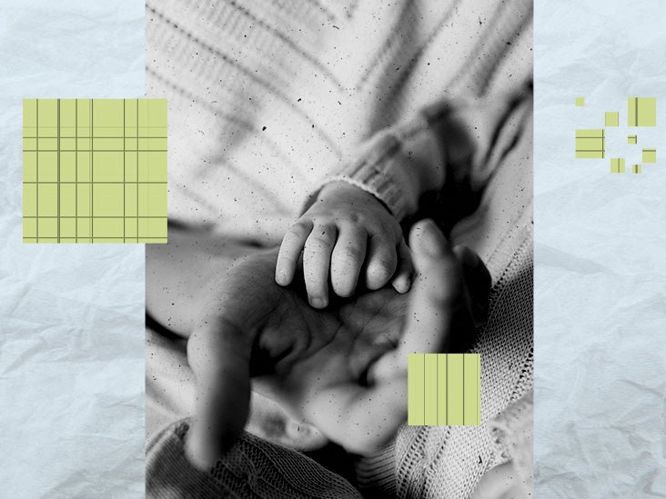 Harlequin ichtyosis in babies: What it is and symptoms