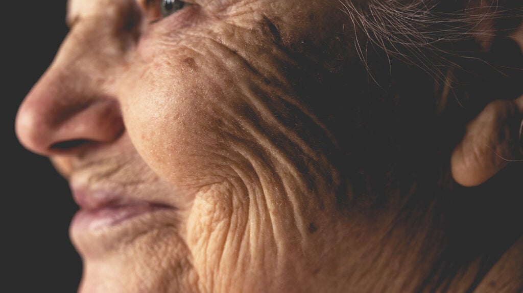 Dementia and dark humor What the research says and how to cope