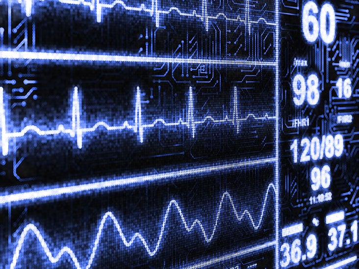 1st degree heart block Causes, symptoms, and treatment