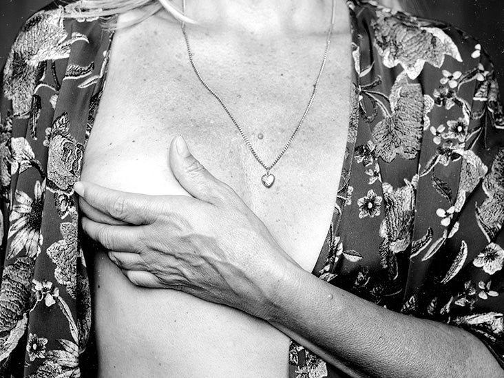 Spot on the breast: rash, or something else?