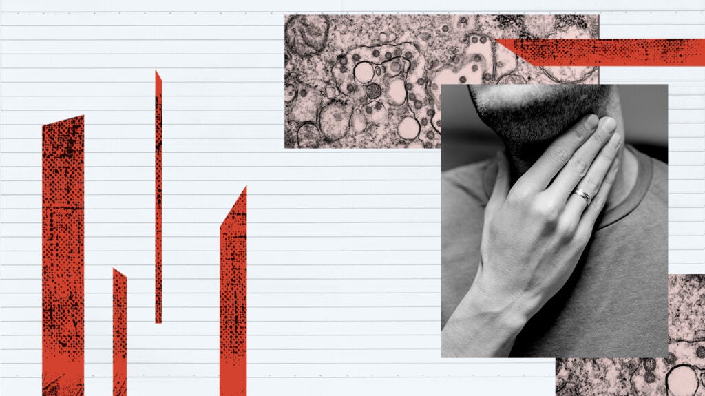 Swollen lymph nodes and COVID: Links and more Swollen lymph nodes and COVID: Links and more