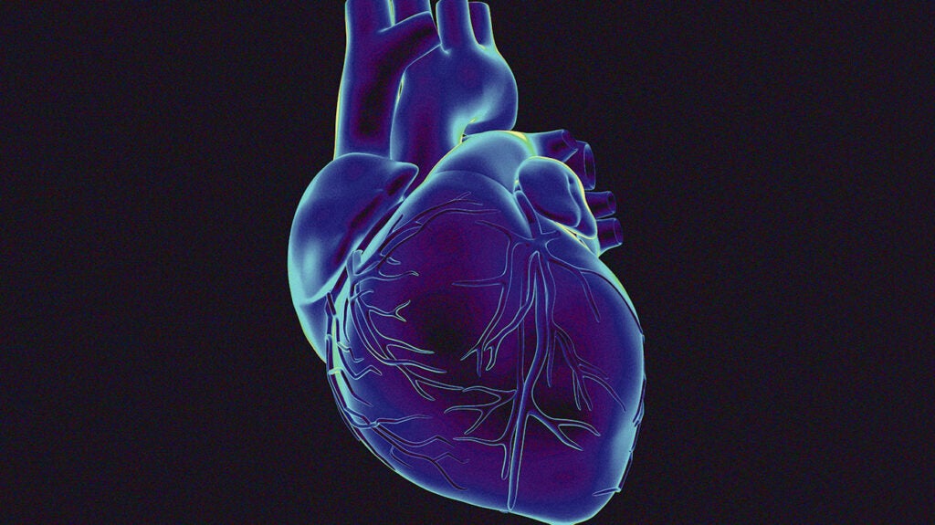 Rheumatic Heart Disease Risk Factors Symptoms Treatment And More rheumatic-heart-disease-risk-factors-symptoms-treatment-and-more
