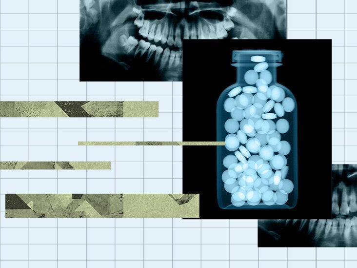 toothache-medication-collage-thumb-732x549.jpg