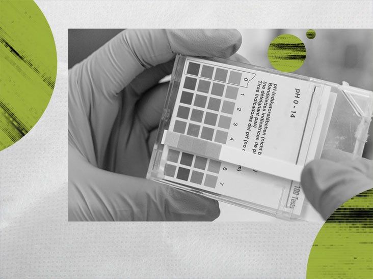 Metabolic alkalosis Causes, symptoms, and treatment