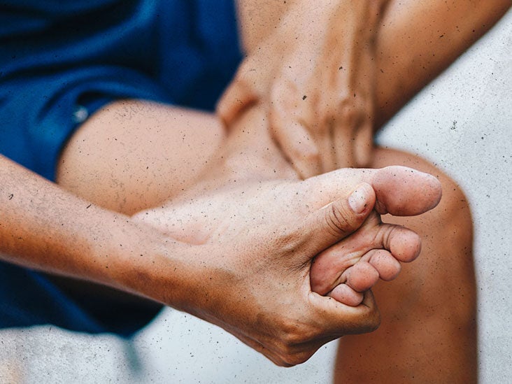 Eczema on feet: Types, symptoms, causes, and more