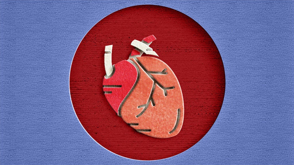 Heart valve regurgitation Causes, symptoms, and treatment