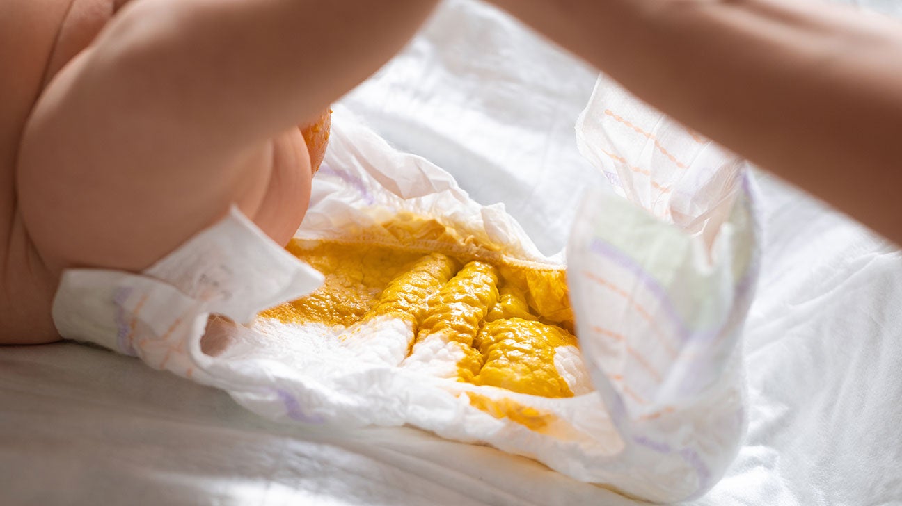 Lactose Intolerant Poop