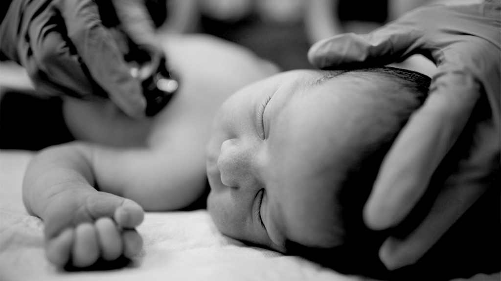 What to know about ASD or a hole in the heart