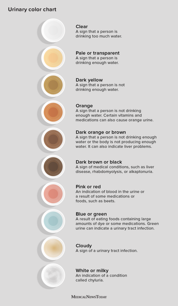 Period blood colour chart: black, brown and bright red meaning