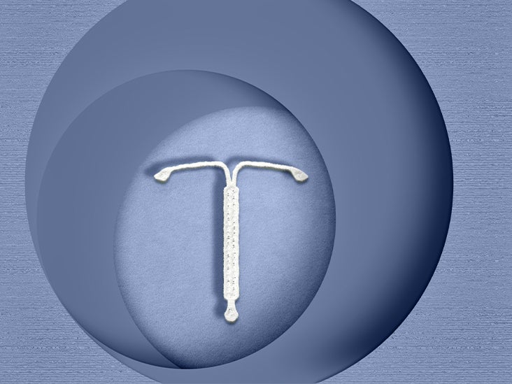 Do IUDs cause pelvic inflammatory disease? What to know