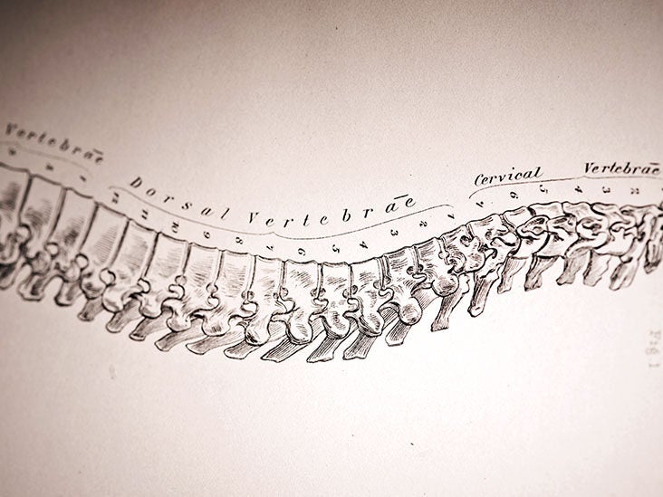 7 Facts You May Not Know About Spinal Stenosis