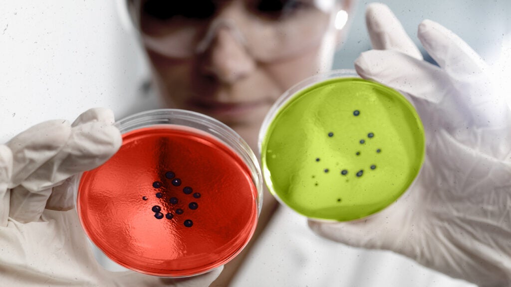 The World's Toughest Bacterium Can Withstand Anything From