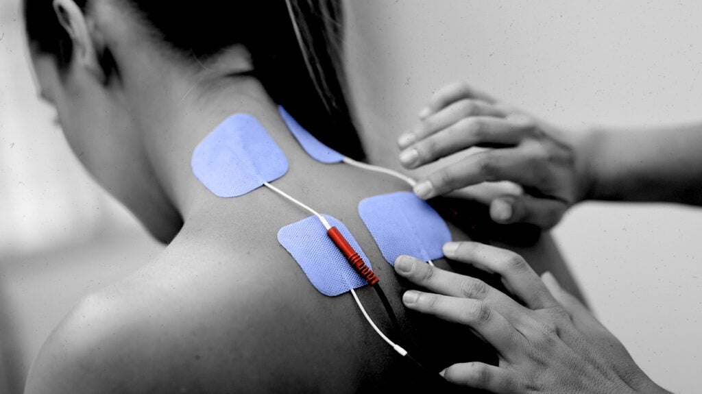 Somatosensory evoked potential (SEP) test What to know