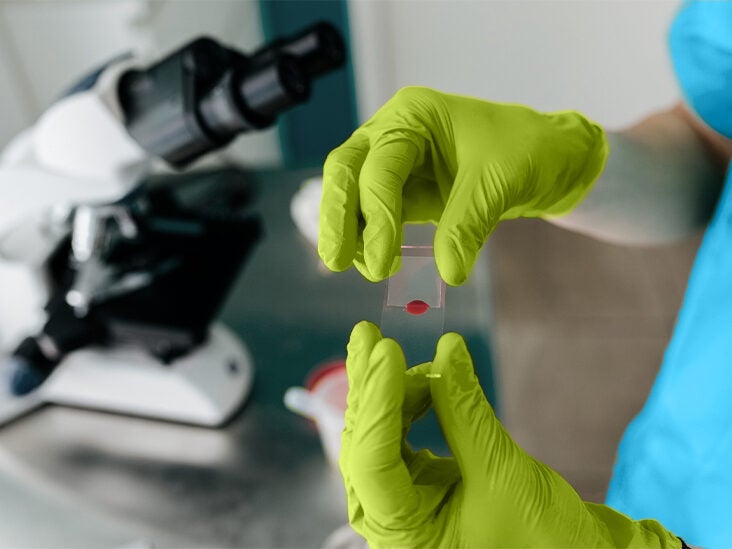 Elevated Antibodies In Blood