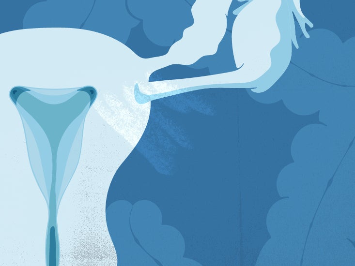 Endometriosis vs. IBS Differences, similarities, and more