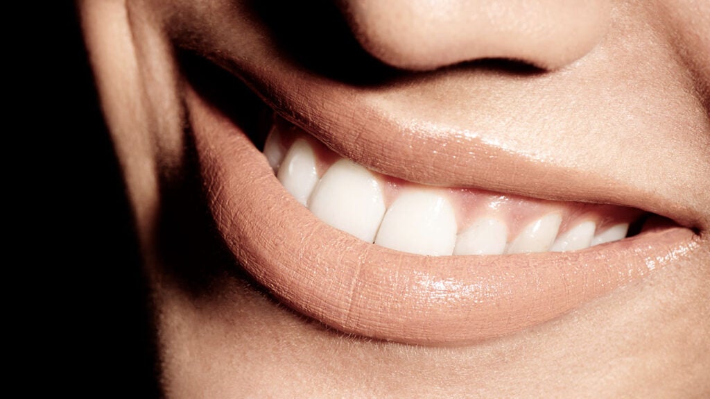 Gingivectomy Procedure, pictures, and more