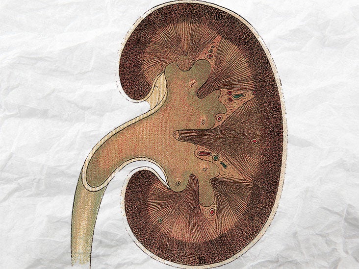 Kidney visual data 8