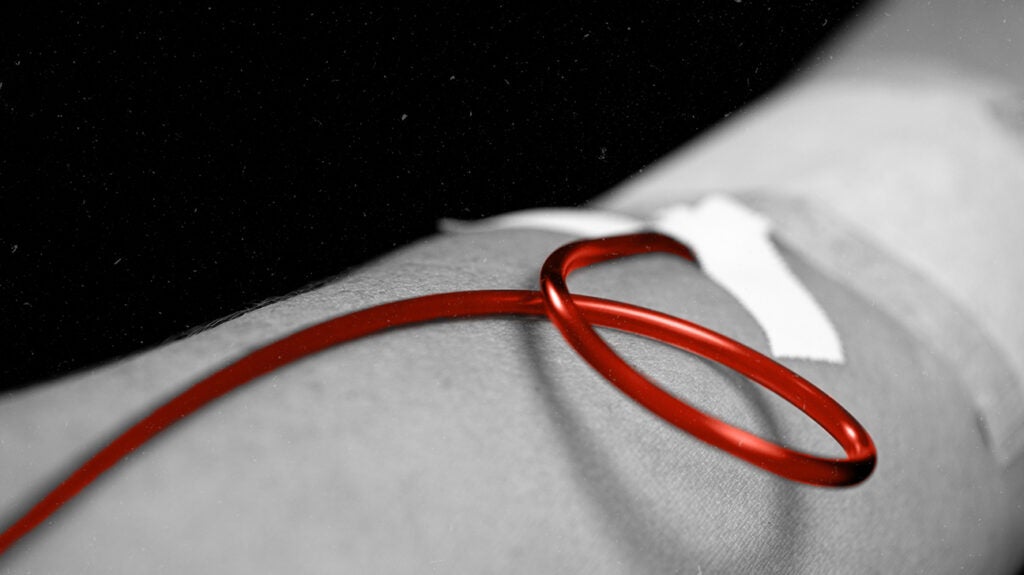 What blood thinner is least likely to cause intestinal bleeding?