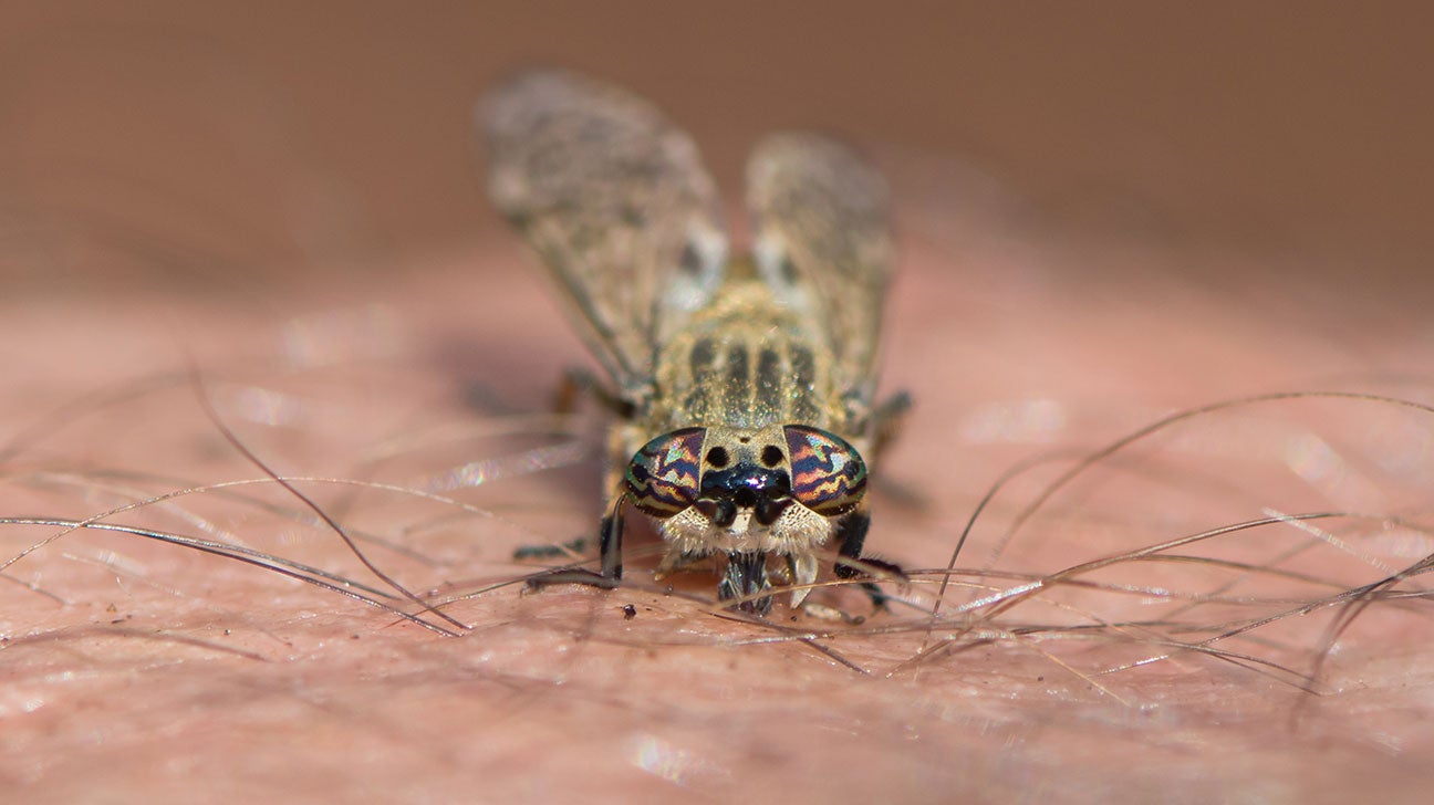 Horse Fly Bite Infection