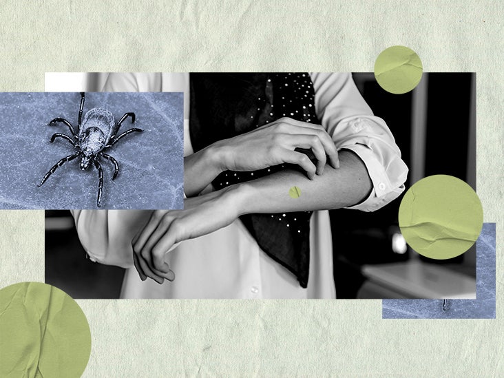 Ticks that transmit Lyme disease What do they look like?