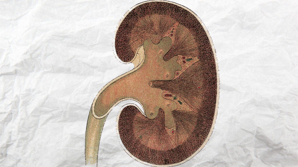 KIDNEY AND RENAL FAILURE visual data 7