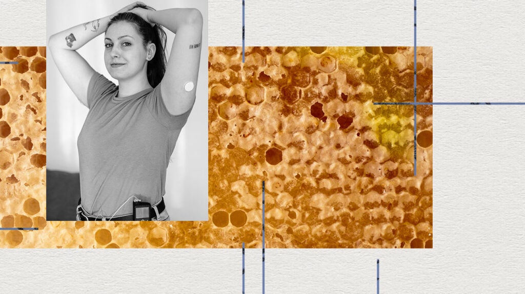 Is honey good for you if you have type 2 diabetes?