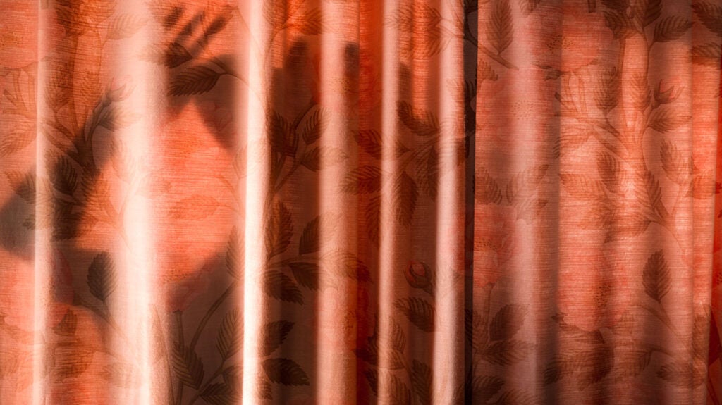 Why does sun exposure trigger a lupus rash?