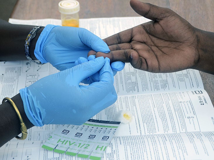 Testing negative for HIV Why might it be a scary time for someone?