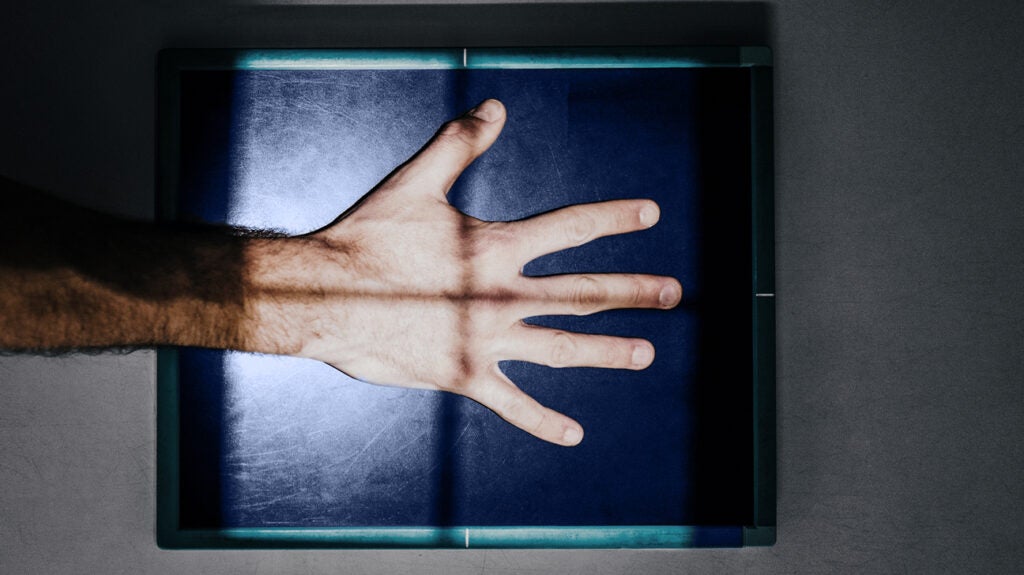 bone-cancer-and-x-rays-appearance-and-next-steps