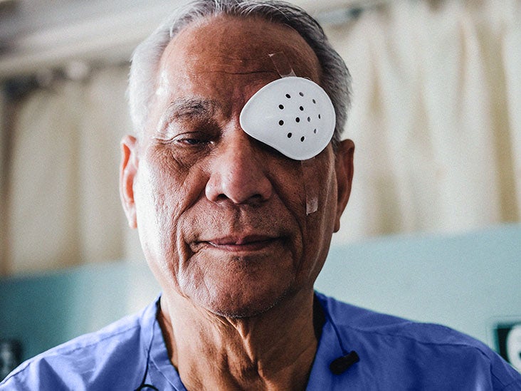 Floaters After Cataract Surgery Treatment And Causes