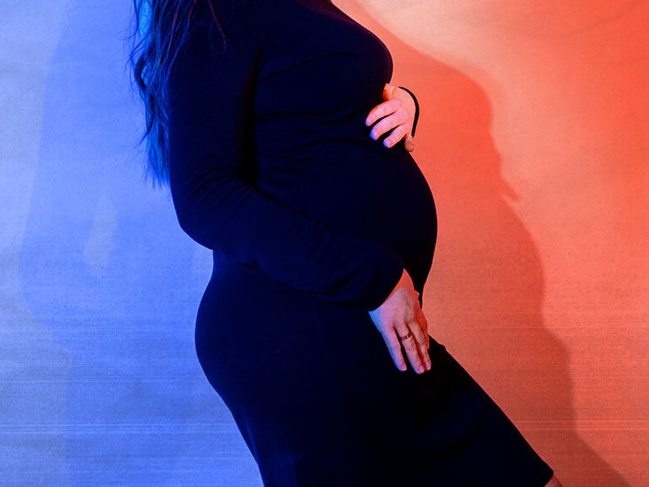 Seizures during pregnancy What to know